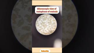 Metaphase of meiosis cell division xii bio  shorts  sa [upl. by Sivrep]