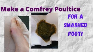 How to Make a Comfrey Poultice for a Smashed Foot [upl. by Aw]