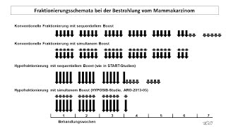 Hypofraktionierung beim Mammakarzinom  Strahlentherapie Prof Hilke Vorwerk [upl. by Eddy]