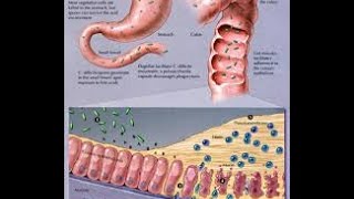 Clostridium Difficile [upl. by Onaicram]