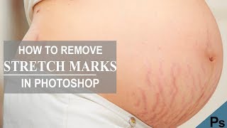 How to Remove Stretch Marks in Photoshop [upl. by Nekial]