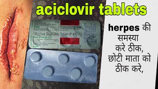 Aciclovir dispersable tablets ip 400mg  acivir tablets uses in hindi [upl. by Montagu540]