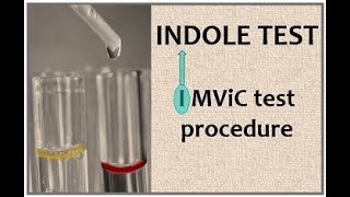 Indole Testprincipleprocedureresults [upl. by Andriette]