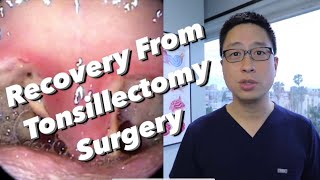 PostTonsillectomy Overview pain control diet bleeding concerns physical limitations [upl. by Eibrik727]