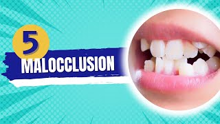 Malocclusion  Orthodontics course [upl. by Sculley]