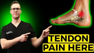 Posterior Tibial Tendonitis Treatment Inside of the Ankle Pain [upl. by Lednem981]