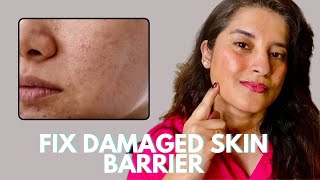 Signs your skin barrier is damaged and how to fix it ft Kass Skincare [upl. by Mcadams]