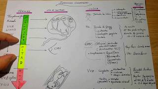 Esquema Infecciones Neonatales [upl. by Odilo]