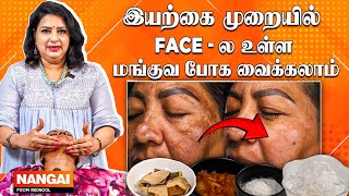 முகத்தில் மங்கு மறைய இதை செய்யுங்கள் Remedy for Black Patches in Face 😲 Beauty Therapist Vasundhra [upl. by Elita]