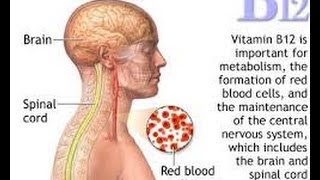 Am I Vitamin B12 Deficient [upl. by Sayers]