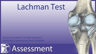 Lachman Test  Anterior Cruciate Ligament [upl. by Aropizt]