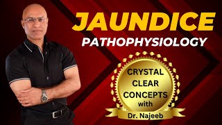 Pathophysiology Of Jaundice  Dr Najeeb Lectures [upl. by Vano]