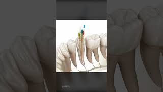 What To Expect During a Root Canal Is It Right For You [upl. by Robers]