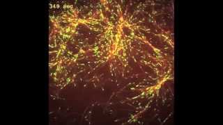 FIRST PLACE Microtubules Branch Out [upl. by Tennaj]