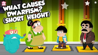 What Causes Dwarfism  Growth Disorder  The Dr Binocs Show  Peekaboo Kidz [upl. by Oirretno]