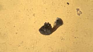 A single fern sporangium hurling spores video 1 [upl. by Allesig]