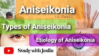 What is Aniseikonia  Types of Aniseikonia  Aniseikonia in Tamil  Study with Jeslin [upl. by Server]