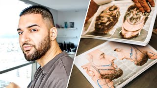 Meine Haartransplantation in der Türkei 🇹🇷 Ergebnisse nach 3 Jahren  Vorher amp Nachher [upl. by Butterworth]