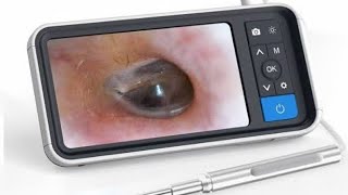 Otoscopio  endoscopio ótico WIFI RESEÑA Y UMBOXING ENDOSCOPE TOOL ANDROID [upl. by Yrreg]