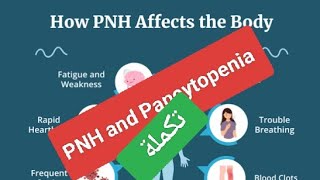 Male patient with pancytopenia التكمله [upl. by Nyral]