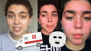 MY EXTREME ALLERGIC REACTION TO A FACE MASK STORYTIME [upl. by Atnamas]