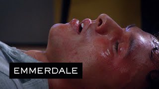 Emmerdale  Jacob Has A Severe Allergic Reaction [upl. by Market502]