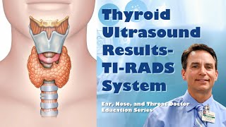 Thyroid Ultrasound Results  TI RADS rating system [upl. by Hgielrac]