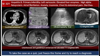 1001 Body Imaging Cases 0027 [upl. by Ednew]