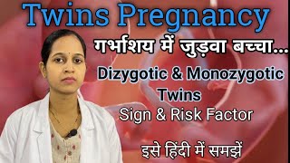 Twins pregnancyDizygotic Monozygotic twins Importfor all nursing exams गर्भाशय में जुड़वा बच्चा [upl. by Daniala]