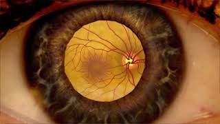 Patient Information  Dilated Eye Examination [upl. by Aker]