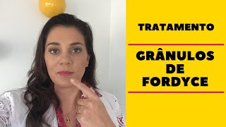 📌 TRATAMENTO PARA GRÂNULOS DE FORDYCE 👩🏻‍⚕️ [upl. by Ahsinyar]