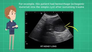 Does a simple kidney cyst require follow up  POCUS pearls [upl. by Colbye902]