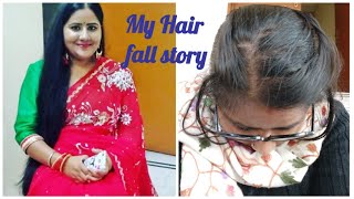 My hair loss storyTelogen effluviumExcess Hair fallHair careHair fall treatment [upl. by Jonati]