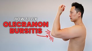 How to do exercises for Olecranon Bursitis  One cause of elbow pain in the triceps region [upl. by Cameron]