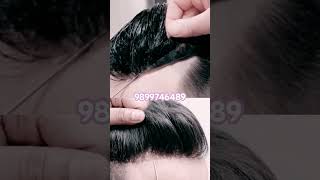 Skin Base Hair Patch System  100 Natural Look hairreplacement hairsystem wigs shorts delhi [upl. by Lucien]