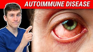 The SHOCKING Truth about Autoimmune Disease and Eye Health [upl. by Ordway]