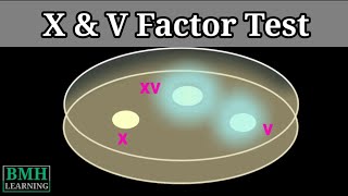 X amp V Factor Test  X V XV Factor Test For Haemophilus Influenzae [upl. by Kelleher]