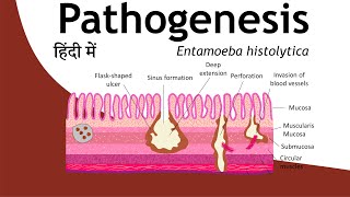 Pathogenesis of Entamoeba histolytica in Hindi  Parasitology Hindi  Basic Science Series [upl. by Pillihpnhoj279]