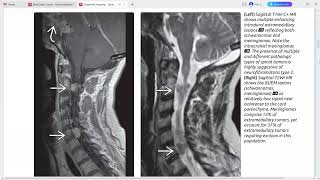 SPINE IMAGING DIAGNOSTIC IMAGING SERIES [upl. by Tina455]