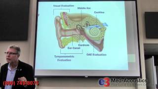 Auditory Evoked Potentials  OtoAcoustic Emissions OAE [upl. by Kym]