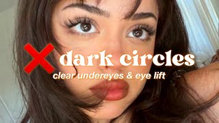 🚫 NO DARK CIRCLES Subliminal ࿐ remove eye bags tear troughs  more [upl. by Thill]