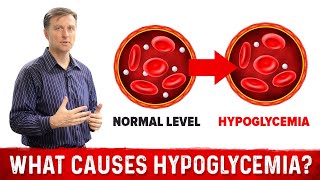 What Causes Hypoglycemia – DrBerg [upl. by Arahsit]