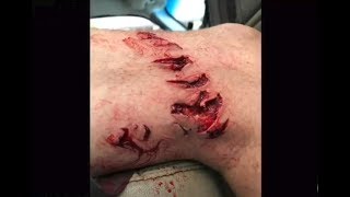 Shark Attacks Man Near Galveston Texas [upl. by Naahs450]