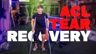 Can I Recover From a Full ACL TEAR  My ACL TEAR Recovery Protocol [upl. by Yanal]