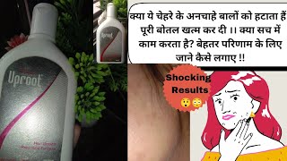 Uproot lotionUproot lotion reviewuproot lotion how to use review pharmacy unwantedhairremoval [upl. by Anitsuga]