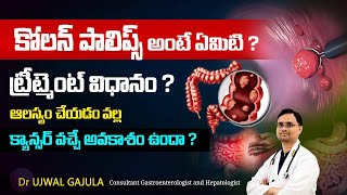 What is Colon Polyps Treatment Procedure  How Does is effect if Delay Does it Effect Cancer [upl. by Tormoria594]