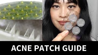 Guide to Acne Patches Hydrocolloid Treatment Microneedle  Lab Muffin Beauty Science [upl. by Crissy]