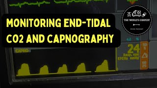 End Tidal CO2 and Capnography [upl. by Nayra]