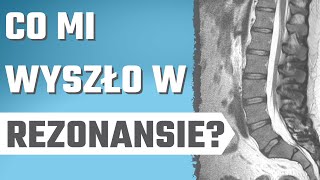 Co jest w opisie REZONANSU  wyjaśniam  przepuklina dyskopatia wypuklina kręgozmyk [upl. by Melas]