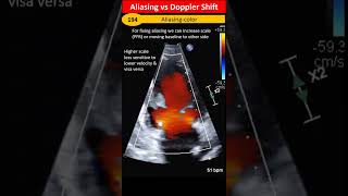 Aliasing vs Doppler Shift [upl. by Ylime]